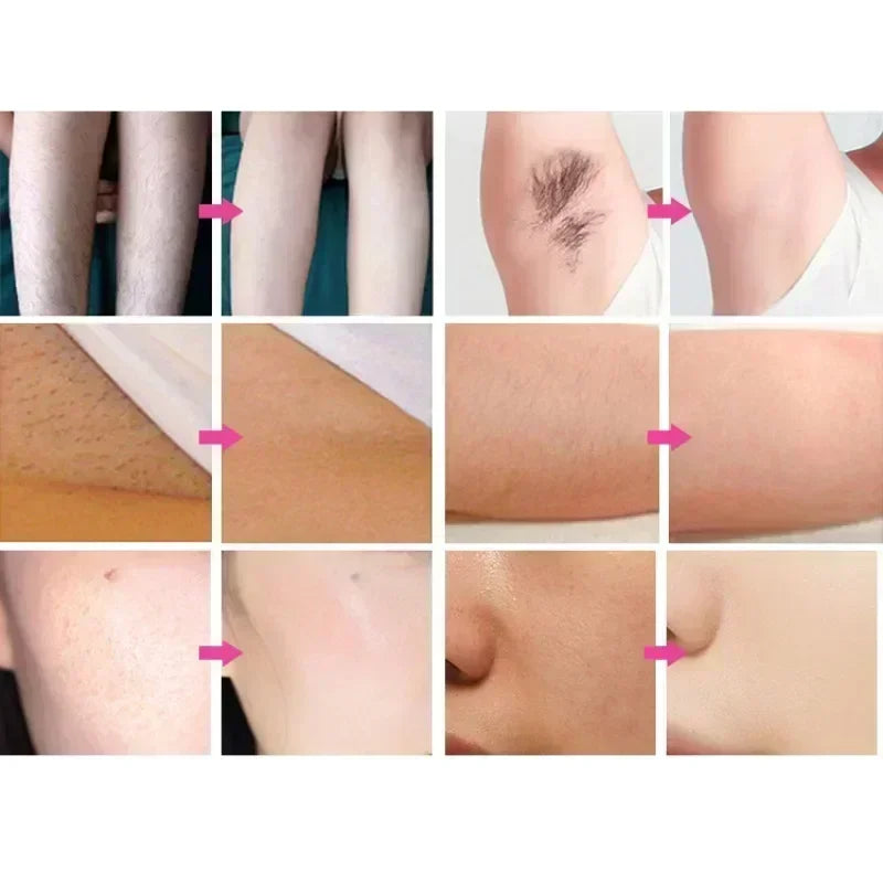 2025 New depiladora Diode Laser Hair Removal Machine Professional Laser Platinum Equipment Titanium Salon Spa Machine