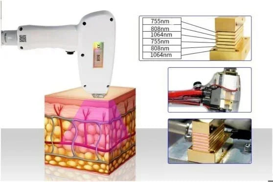 2025 New depiladora Diode Laser Hair Removal Machine Professional Laser Platinum Equipment Titanium Salon Spa Machine