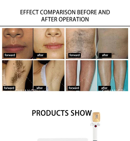 3000W 3 Wavelength 808 Diode Laser Hair Removal Machine Ice Titanium Permanent Painless Physical Body Care Depilation Epilator