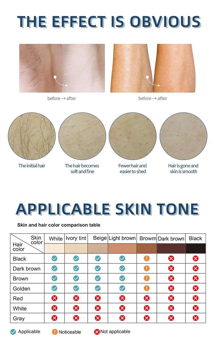 MLAY M3 Laser Hair Removal Device Malay IPL Epilator a laser Electric Epilator 500000 Flashes Home Use Device M3 Laser For Women