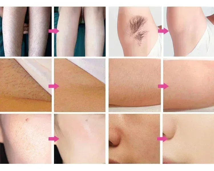 2025 New depiladora Diode Laser Hair Removal Machine Professional Laser Platinum Equipment Titanium Salon Spa Machine
