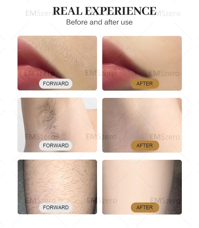 Multifunction 3500W Freezing Point Private Parts Body Face 808nm Diode Laser Hair Removal Machine Permanent Painless Epilator