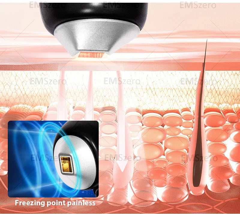 Multifunction 3500W Freezing Point Private Parts Body Face 808nm Diode Laser Hair Removal Machine Permanent Painless Epilator