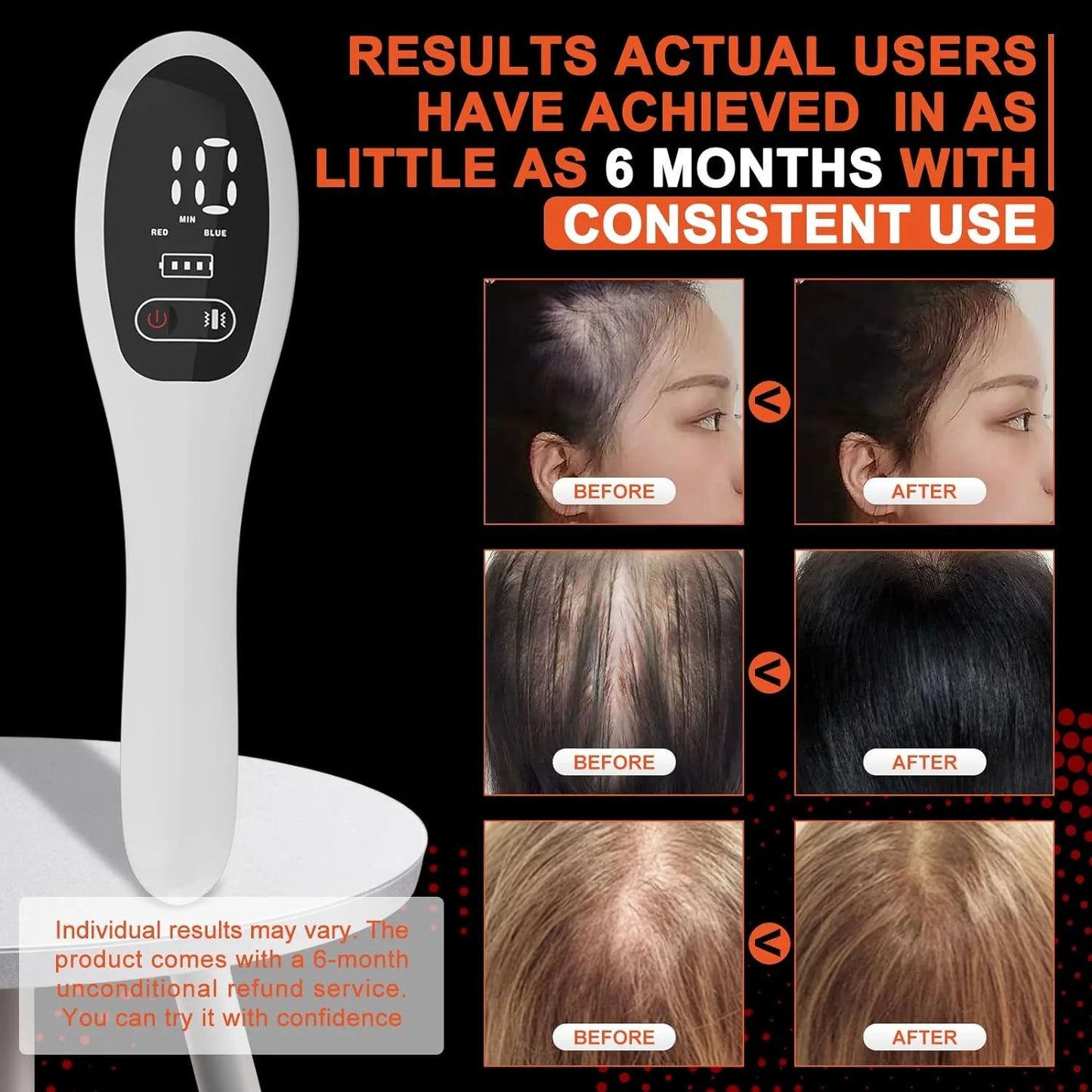 Electric Laser Hair Growth Comb Anti Hair Loss Therapy Comb Infrared 650nm 470nm LED Red Light Vibration Massage Hair Care Brush